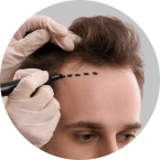 Haartransplantatie icoon